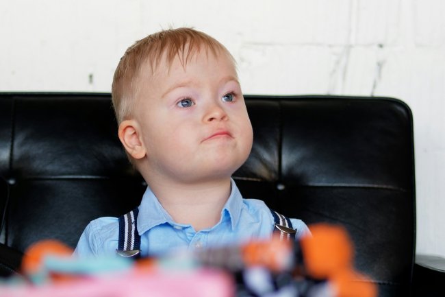 Ilmuwan Temukan Molekul yang Bisa Memperbaiki Otak Pada Kasus Down Syndrome di Usia Dewasa