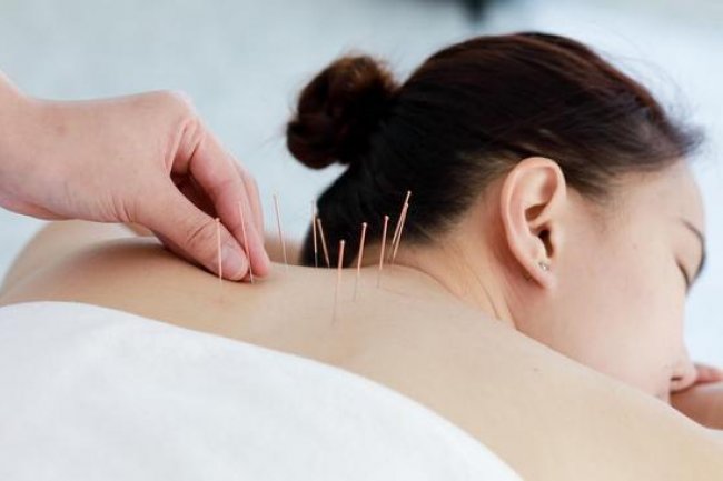 Harapan Baru, Akupunktur Bantu Pulihkan Fungsi Kognitif pada Pasien Kanker Payudara