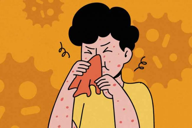 Gejala Super Flu Varian H3N2 Subklade K yang Harus Diwaspadai