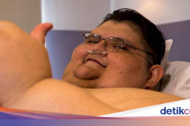 Akhir Tragis Pria Tergemuk di Dunia, Meninggal di Usia 41 Akibat Infeksi Ginjal
