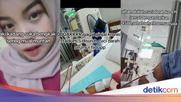 Sempat Dikira Asam Lambung, Wanita Ini Sudah 419 Kali Cuci Darah dalam 4 Tahun