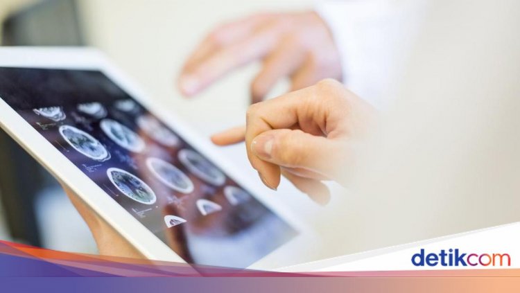 Pria Lebih Berisiko Alami Kanker Otak Akibat Polusi Udara, Ini Risetnya