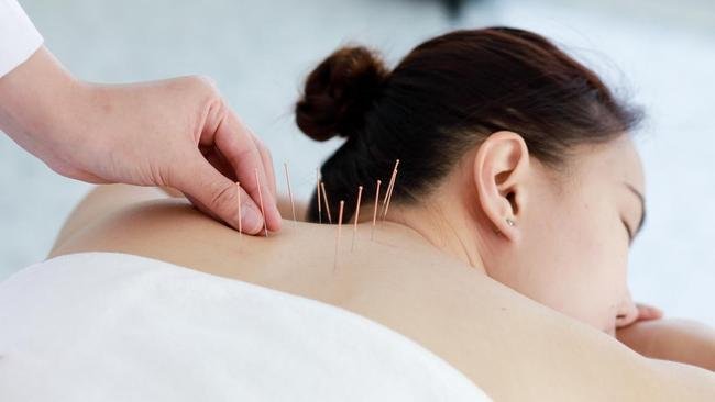 Harapan Baru, Akupunktur Bantu Pulihkan Fungsi Kognitif pada Pasien Kanker Payudara