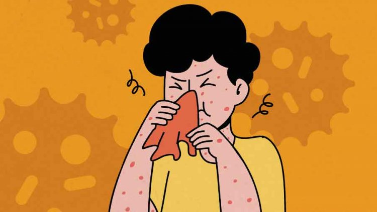 Gejala Super Flu Varian H3N2 Subklade K yang Harus Diwaspadai