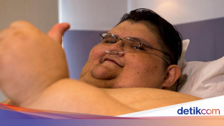 Akhir Tragis Pria Tergemuk di Dunia, Meninggal di Usia 41 Akibat Infeksi Ginjal