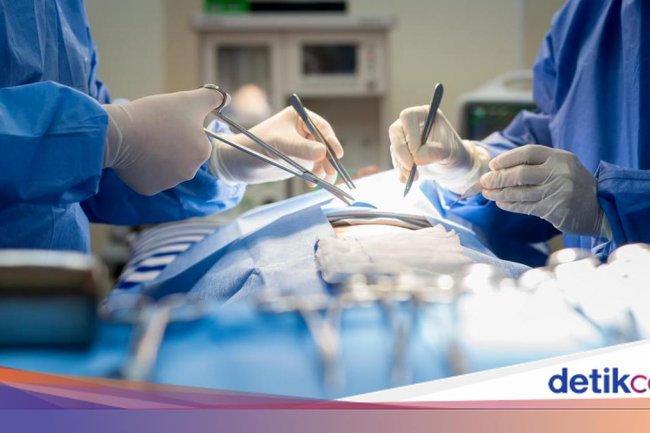 Tren Kecantikan Baru di AS, Oplas Perbesar Bokong-Payudara Pakai Lemak Mayat