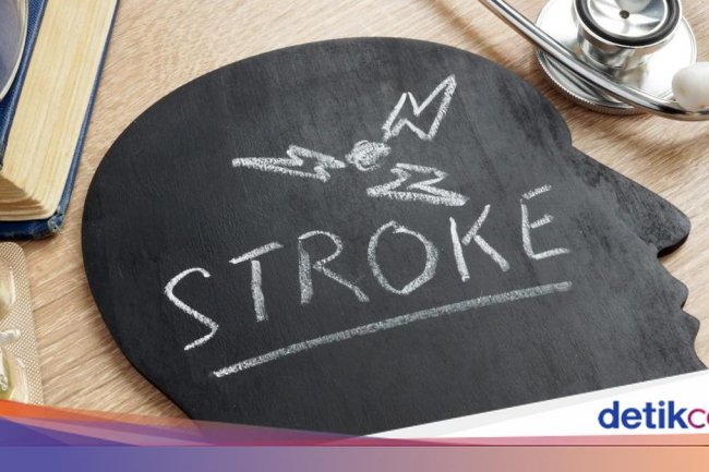 Awal Mula Pria Bugar Usia 23 Tahun Kena Stroke setelah Sering Begadang