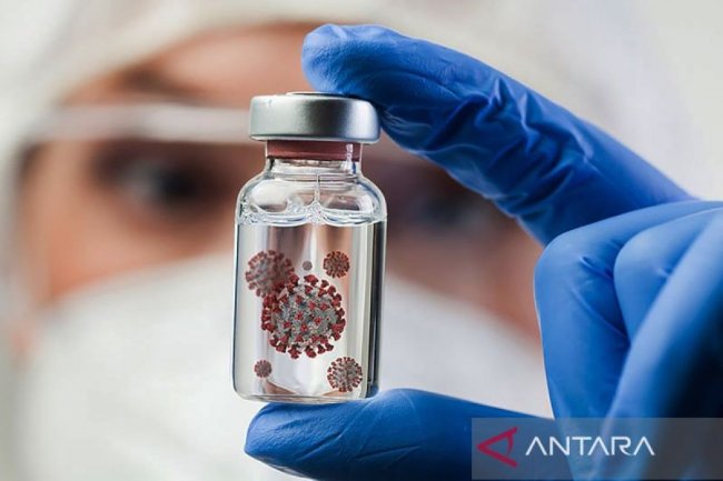 Kemlu pantau kasus virus Nipah di India, pastikan tak ada WNI tertular