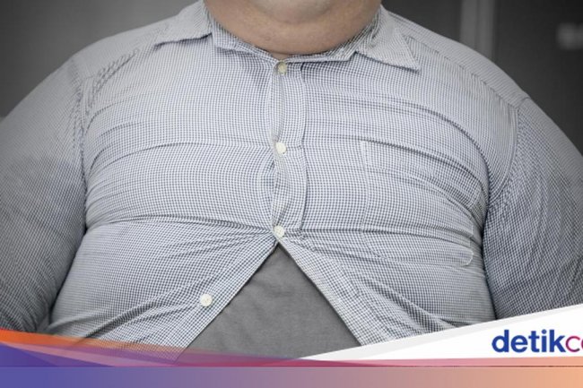 Obesitas Rentan Terjadi di Perkotaan, Kemenkes RI Ungkap Kebiasaan yang Jadi Pemicunya