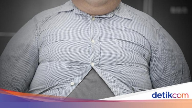 Obesitas Rentan Terjadi di Perkotaan, Kemenkes RI Ungkap Kebiasaan yang Jadi Pemicunya